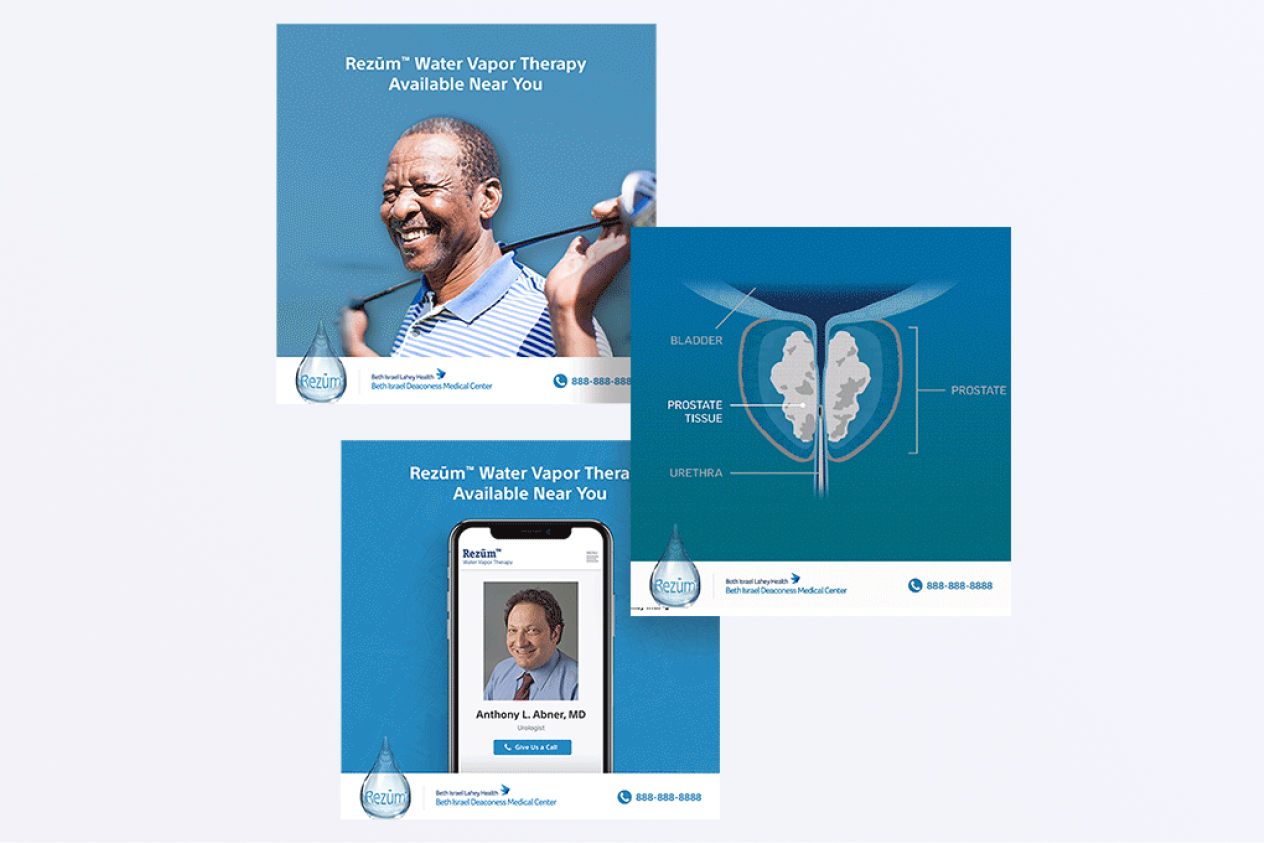 Rezum Water Vapor Therapy brochure showing a happy patient, a medical diagram, and a doctor promoting the treatment.