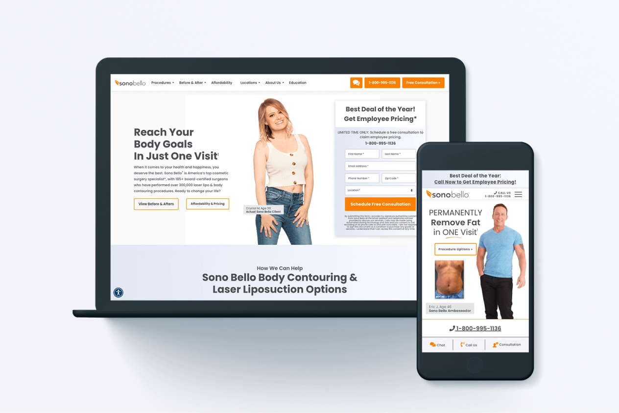 Laptop and smartphone screens displaying a website for Sono Bello body contouring and laser liposuction services.